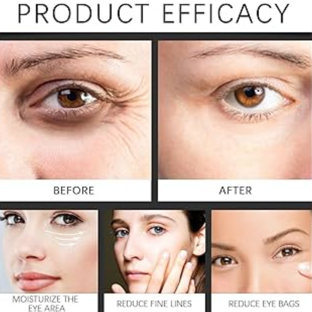 Winter Skincare Bundle(Glycolic Acid Serum with De-Puff Eye Roller)