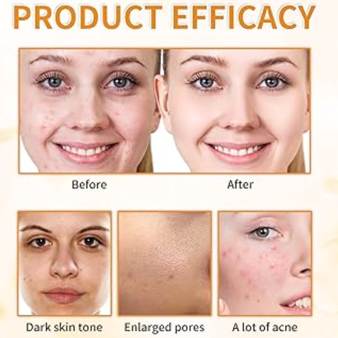 Winter Skincare Bundle(Glycolic Acid Serum with De-Puff Eye Roller)