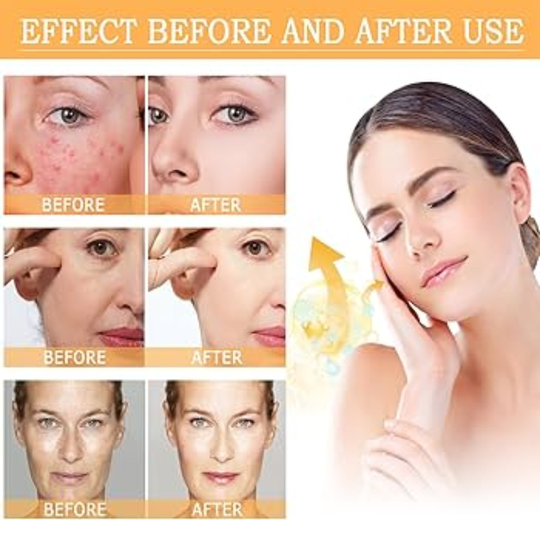 Winter Skincare Bundle(Glycolic Acid Serum with De-Puff Eye Roller)