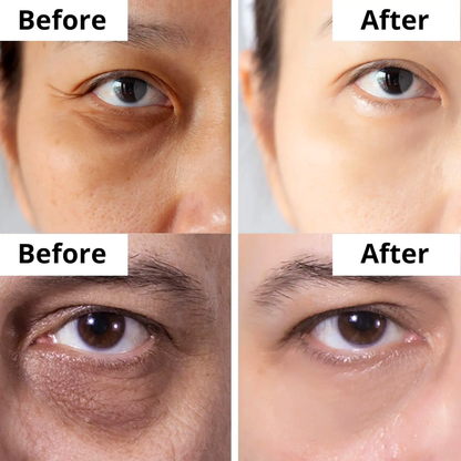 Winter Skincare Bundle(Glycolic Acid Serum with De-Puff Eye Roller)