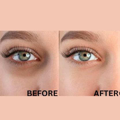 Winter Skincare Bundle(Glycolic Acid Serum with De-Puff Eye Roller)